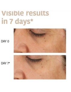 Iroha Nature Maschera Viso in Tessuto Con Macchie Scure... 2