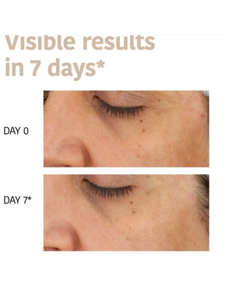 Iroha Nature Maschera Viso in Tessuto Con Macchie Scure Con Acido Tranexaminico