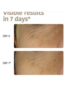 Iroha Nature Maschera Viso in Tessuto Wrinkle Filler Face... 2