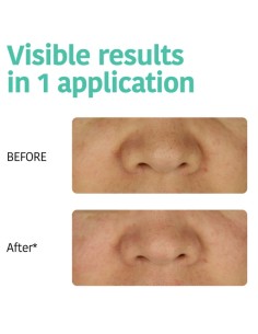 Iroha Nature Strisce Per La Pulizia Profonda dei Pori Del... 2