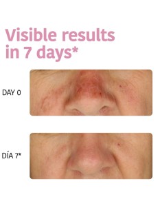 Iroha Nature Maschera Viso in Tessuto Idratante Con Aloe... 2