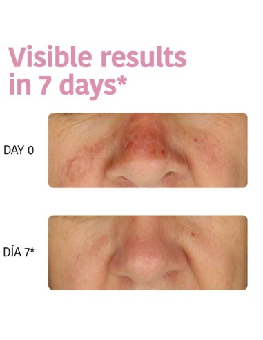 Iroha Nature Maschera Viso in Tessuto Idratante...
