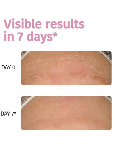 Iroha Nature Maschera Viso in Tessuto Idratante...