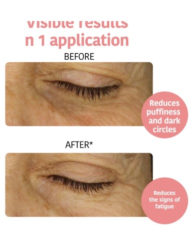 Iroha Nature Patchs Occhi Defaticanti e...