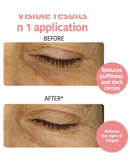 Iroha Nature Patchs Occhi Defaticanti e Illuminanti Con Vitamina C
