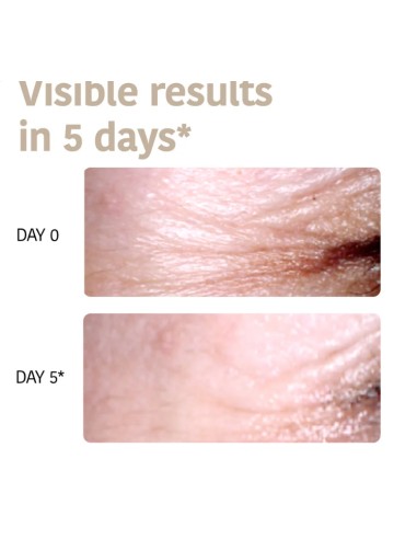 Iroha Nature Patchs Occhi Global Anti-age Con...