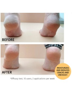 Iroha Nature Maschera Piedi Riparatrice Con Pesca 2