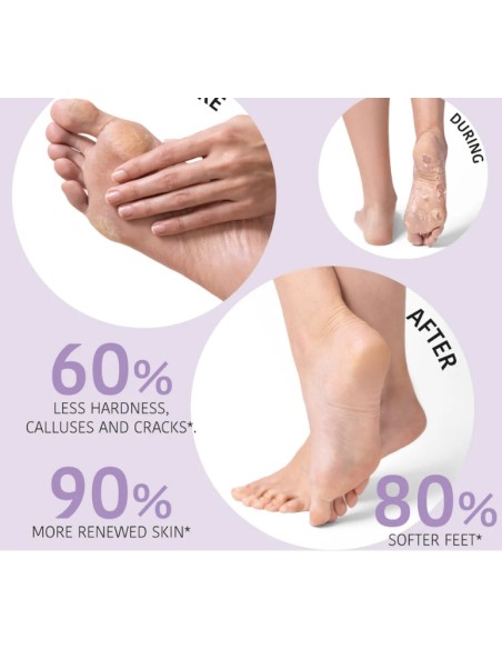 Iroha Nature Maschera Piedi Peeling ed Esfoliante all'Acido Glicolico